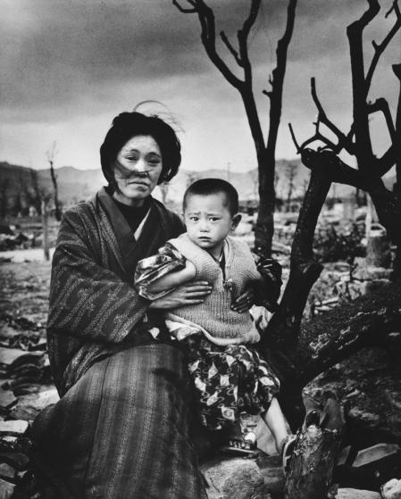 Mother and child in Hiroshima, four months after the atomic bomb dropped.